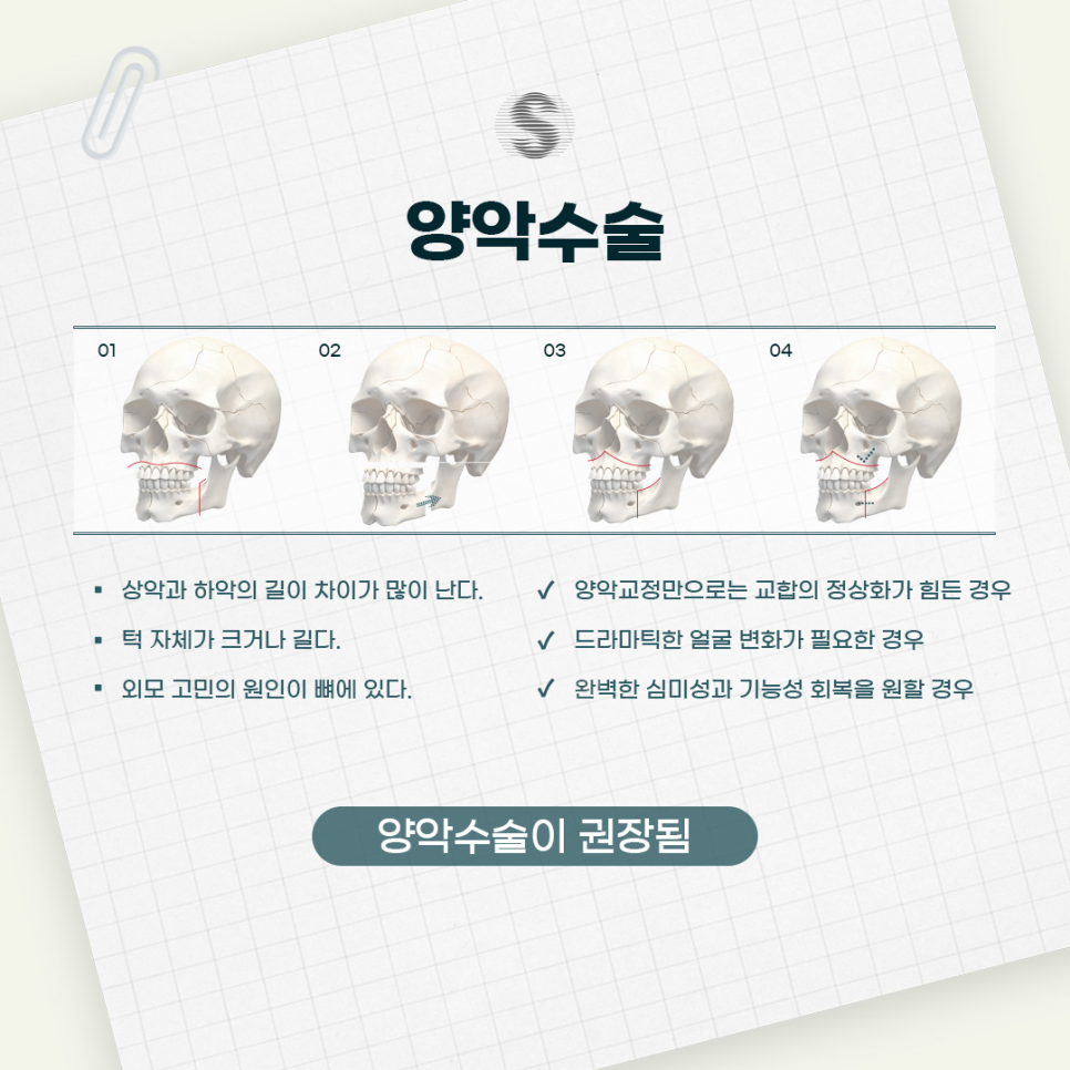 황금보다 빛나는 나의 시절을 위한 황금비율 (비수술양악교정) 관련 이미지 5