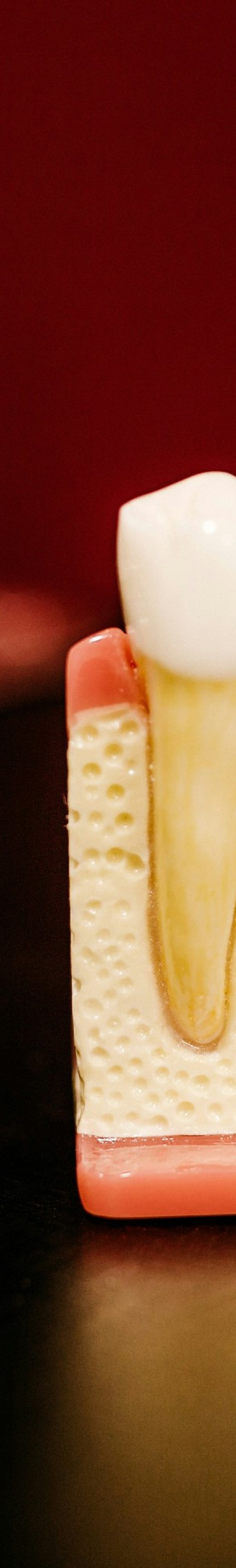 임플란트 식립이 불가능할 수도 있는 건강 상태 알아보기. 관련 이미지 8