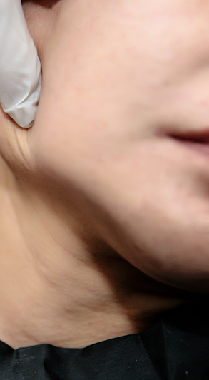 턱통증 치료, 비수술로 해결하는 방법 관련 이미지 10