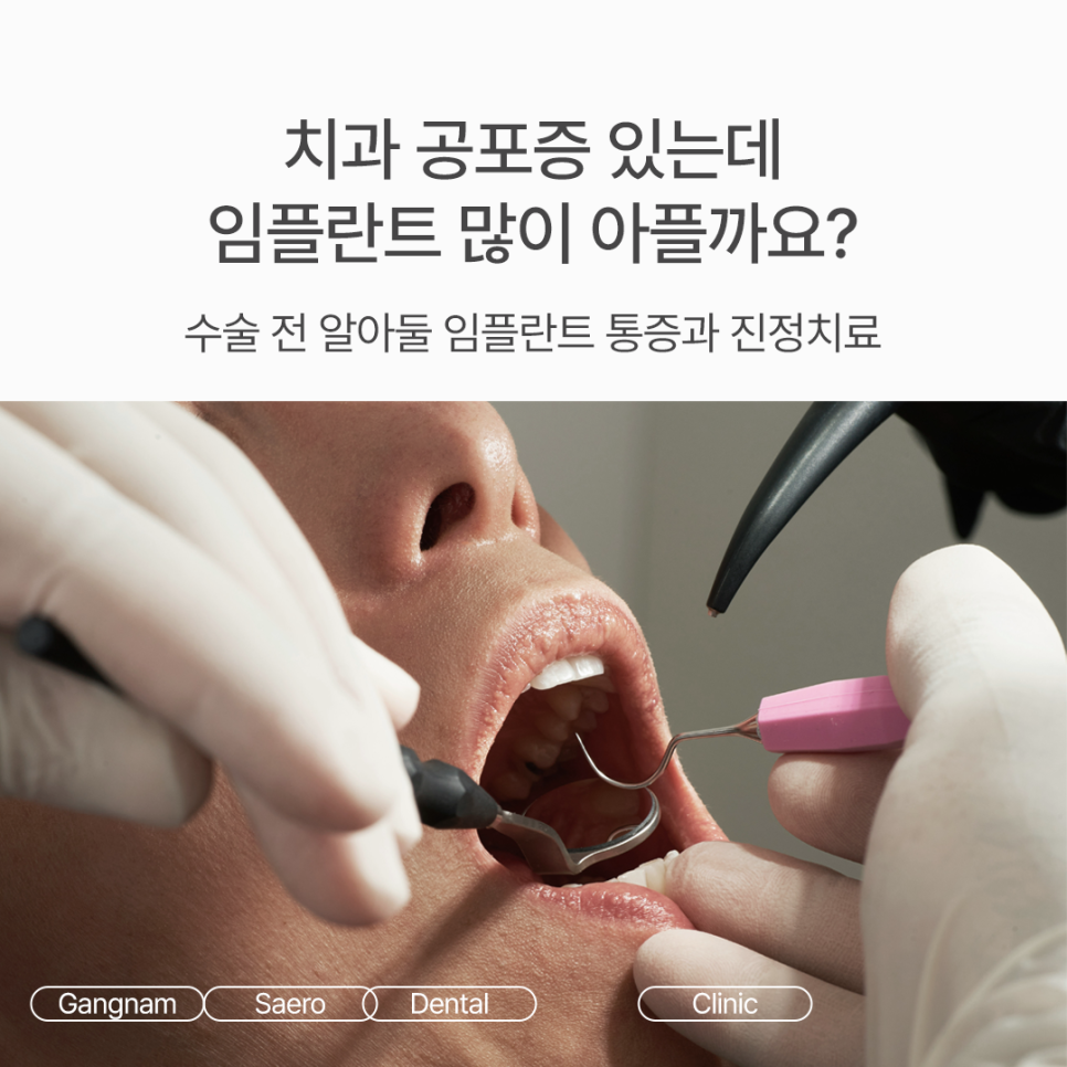 임플란트 많이 아플까요? 수술 전 알아둘 임플란트통증 및 진정치료 관련 이미지 1