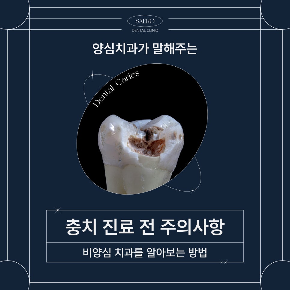 양심치과가 말해주는 충치치료 비양심치과 알아보는 법 [ 강남새로치과 ] 관련 이미지 1