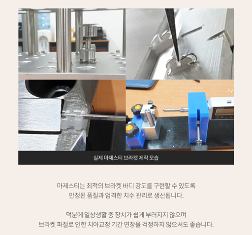 강남새로치과 자가 결찰 교정 오스템교정 (마제스티 트리니티 LPA) 관련 이미지 1