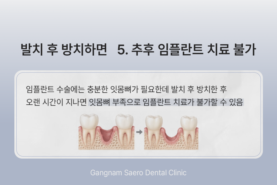 What Happens If You Do Not Get an Implant After Tooth Extraction? (Implants After Tooth Extraction) image 7