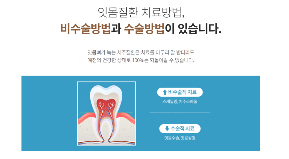 스케일링 왜 받아야 하나요? 통증이 무섭다면 무통으로! 관련 이미지 2