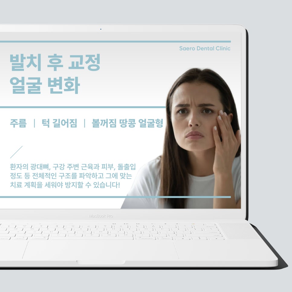 무조건 비발치교정 이 좋은 선택일까요? (발치교정이유 비발치교정이유) 관련 이미지 2