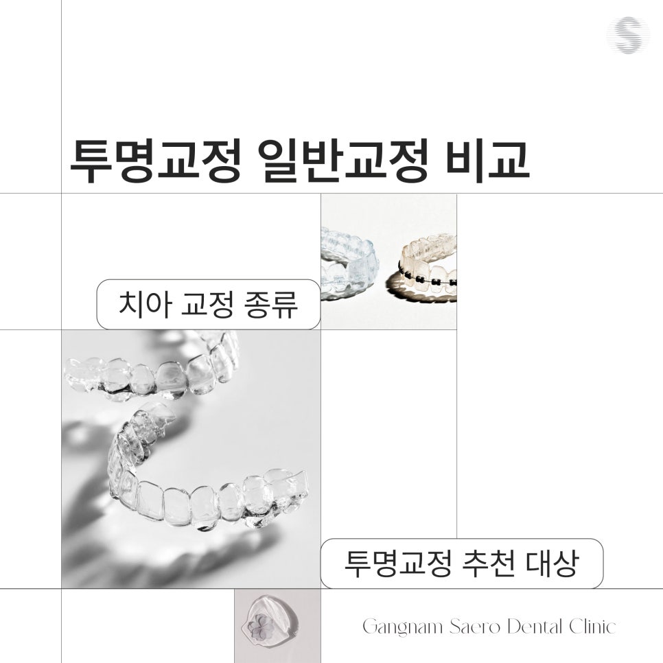 치아교정종류 파헤치기 (투명교정 일반교정 비교) 관련 이미지 5