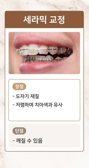 강남새로치과 치아교정종류 통해 맞춤형 교정 진료 (치아교정종류) 관련 이미지 3