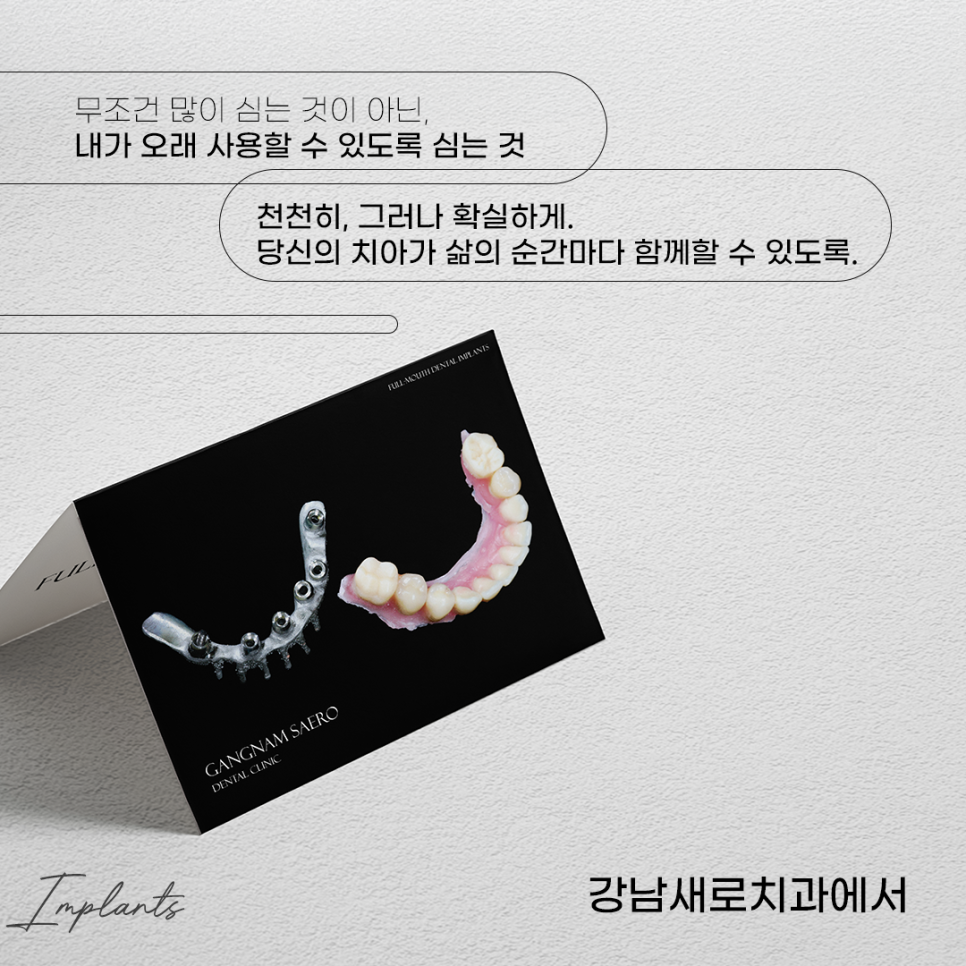 전체 임플란트 건강보험 적용 (65세이상임플란트) 관련 이미지 7