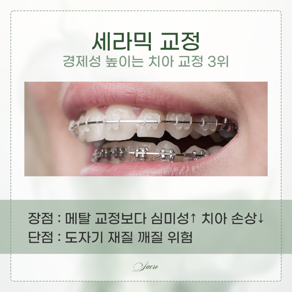 치아교정 가격이 어떻게 되나요? (치아교정비용) 관련 이미지 5