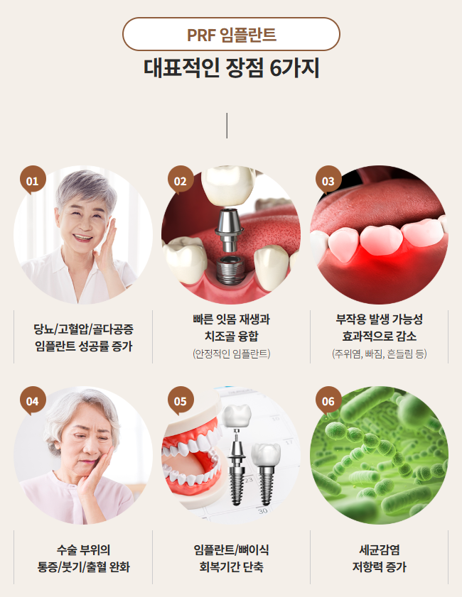 당뇨, 고혈압, 골다공증 임플란트수술 은? (PRF임플란트 자가혈임플란트) 관련 이미지 2