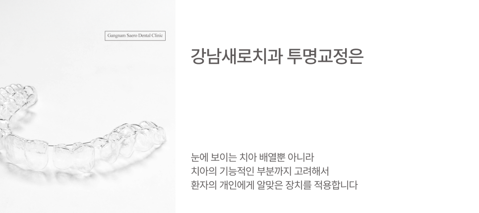 투명교정후회 안 하려면, 투명교정 시작 전 반드시 알아야 할 효과 회귀 재발 관련 이미지 6