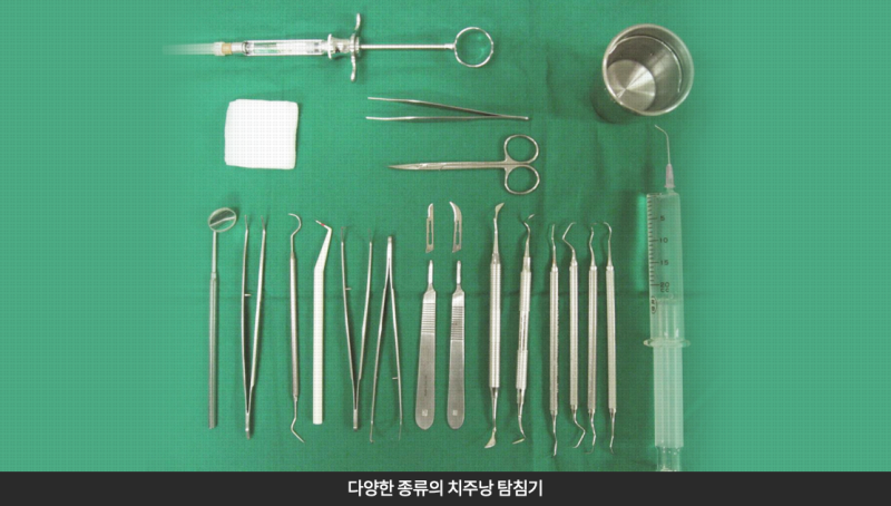 잇몸에서 피가 난다면, 관련 이미지 10