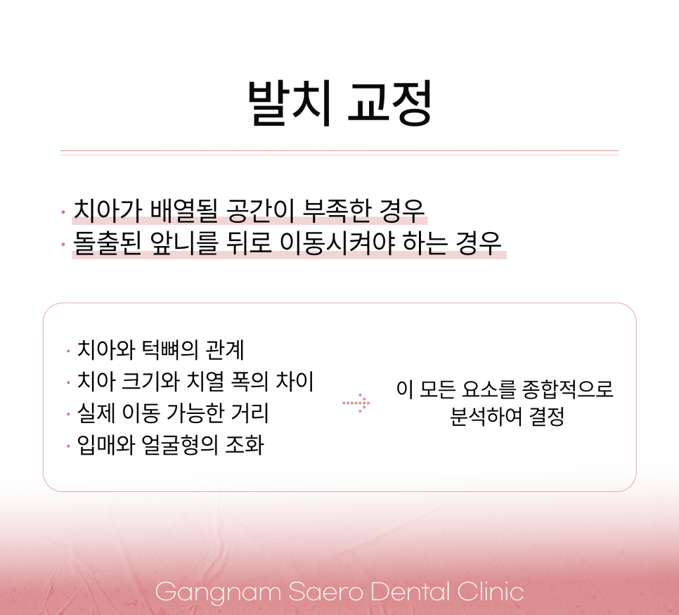 비발치 교정이 다 좋지만은 않은 이유 (발치교정 이유) 관련 이미지 2