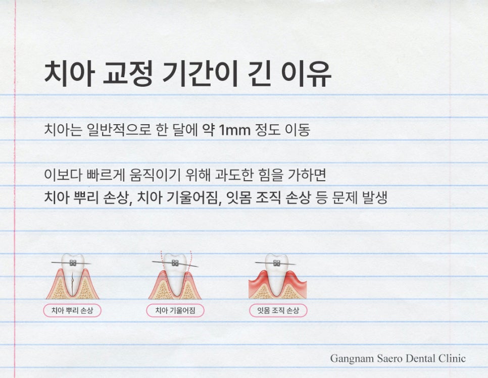 치아교정 많이 아픈가요? 통증 이유와 줄이는 방법 (치아교정통증) 관련 이미지 3