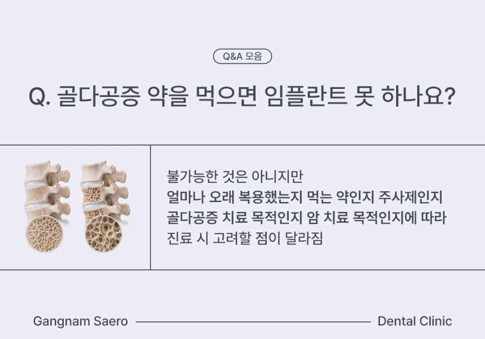 임플란트 구체적인 질문 MRI, 골다공증, 치아교정, 충치 Q&A 모음 관련 이미지 3