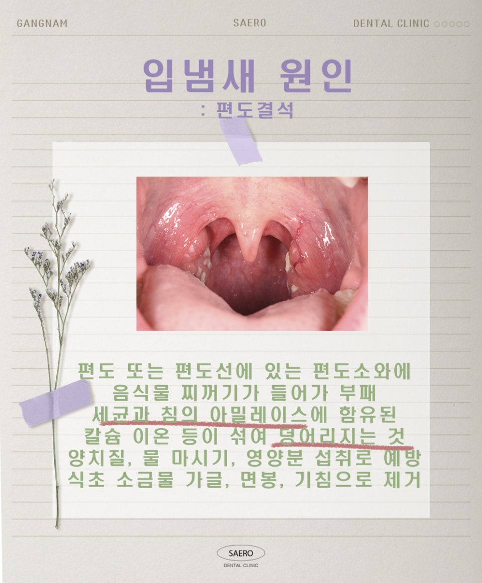 양치질을 해도 입냄새가 난다면 (구취 원인과 해결법) 관련 이미지 5