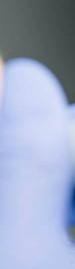 구강질환을 예방하는 치주질환치료 관련 이미지 7