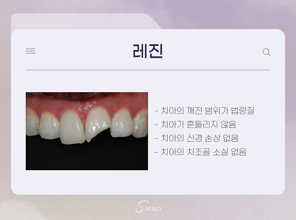 앞니 손상 시 치료 방법 (앞니깨졌을때) 관련 이미지 4