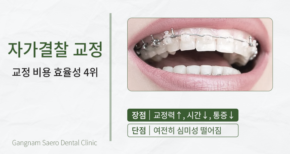 A Time- and Money-Saving Approach to Orthodontic Treatment (Orthodontic Treatment Cost) image 5