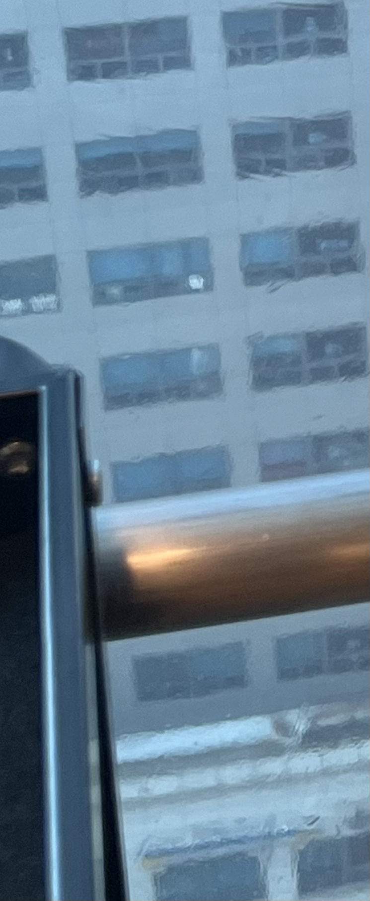 발치 후 교정, 이빨을 뽑지 않는 치료 방법이 있다? 관련 이미지 9