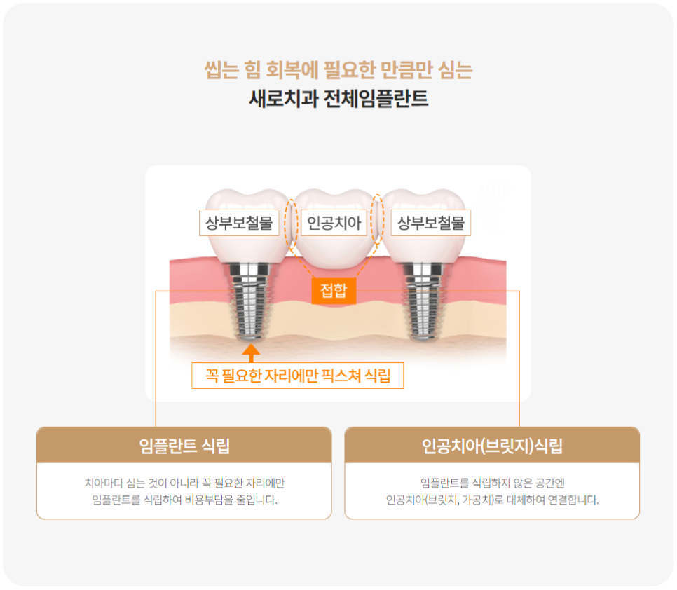 부모님세대 5060을 위한 임플란트 (상악동거상, 당뇨, 고혈압, 골다공증, 무치악 임플란트) 관련 이미지 8