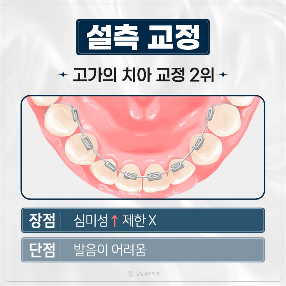 치아교정가격 교정비용비교 교정비용정리 (치아교정비용) 관련 이미지 6
