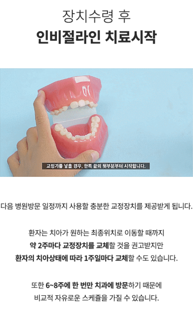 투명치아교정, 발치없이 인비절라인으로 치료 진행 관련 이미지 7