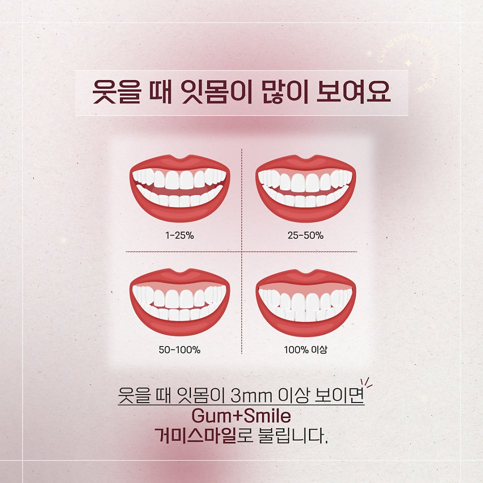 잇몸이 돌출되었을 때 해결방법 (잇몸돌출교정) 관련 이미지 2