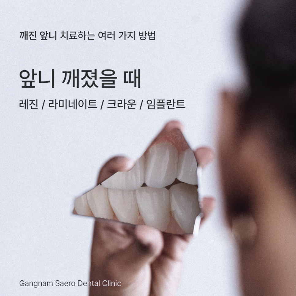 앞니깨졌을때, 깨진앞니 치료하는 여러 가지 방법 레진 / 라미네이트 / 크라운 / 임플란트 관련 이미지 1