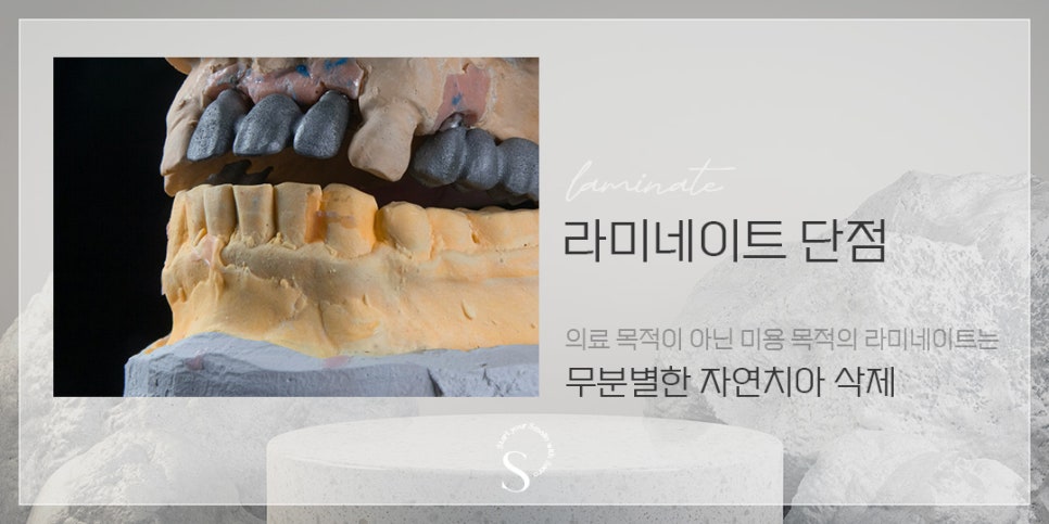 라미네이트 대체 시술 에어네이트 (삭제제로라미네이트) 관련 이미지 3