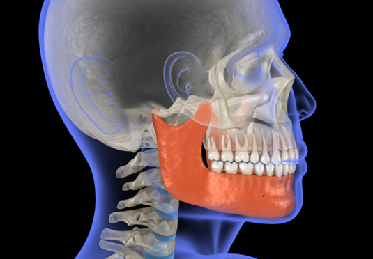 교정 부작용 총정리 [ 교정 부작용 예방법 ] [ 강남새로치과 ] 관련 이미지 2