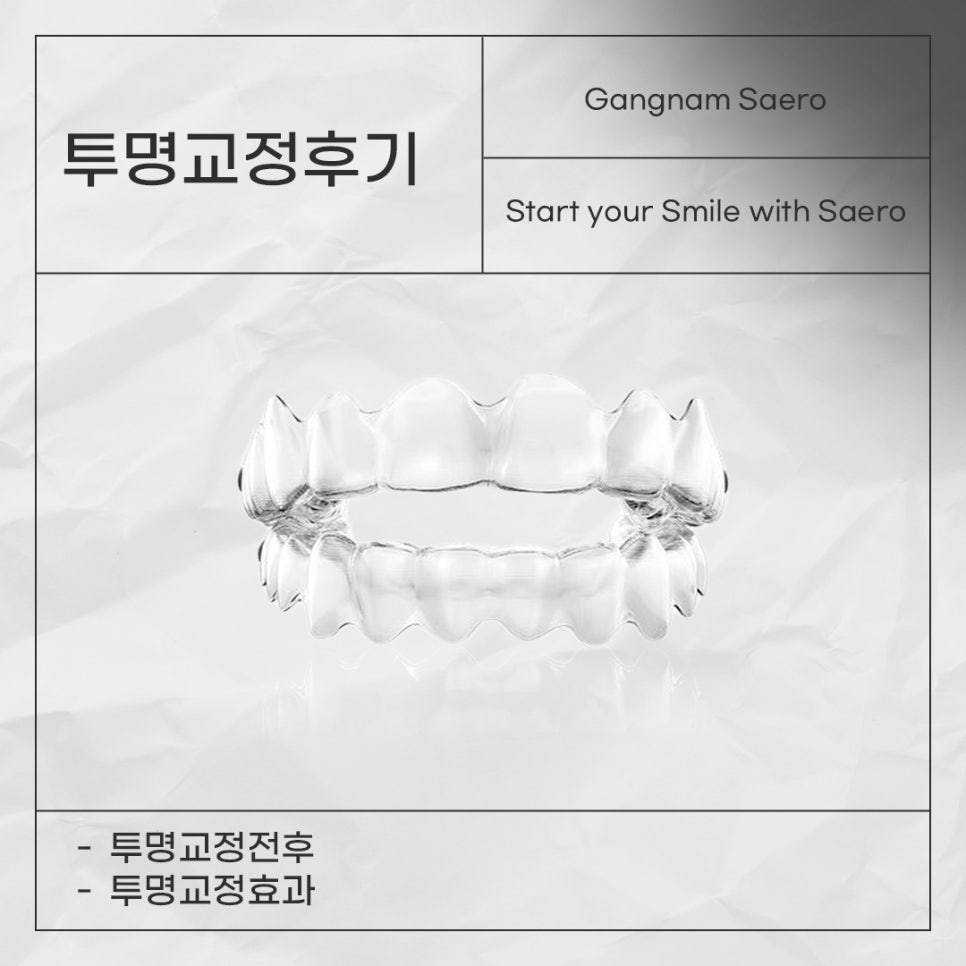 투명교정전후 투명교정효과 투명교정후기 (서울교정치과) 관련 이미지 1