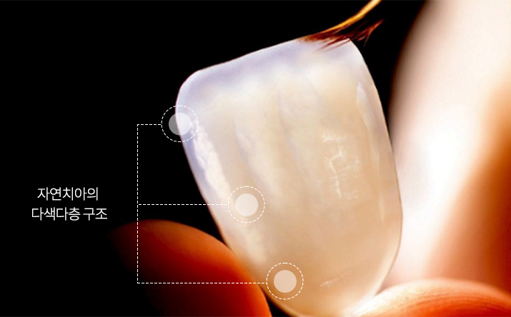 라미네이트 하기 전 고려해야 할 사항 관련 이미지 5