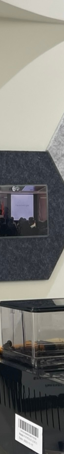 벌어진앞니 교정 치료, 발치 없이 진행하려면? 관련 이미지 18