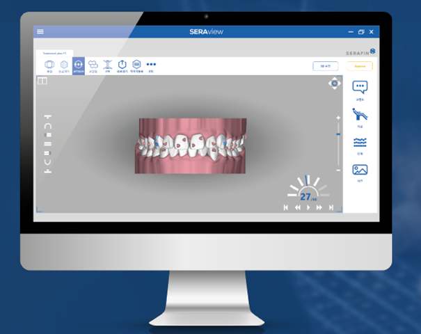 투명교정회사 투명교정종류 투명교정장치 (4) 세라핀 관련 이미지 4