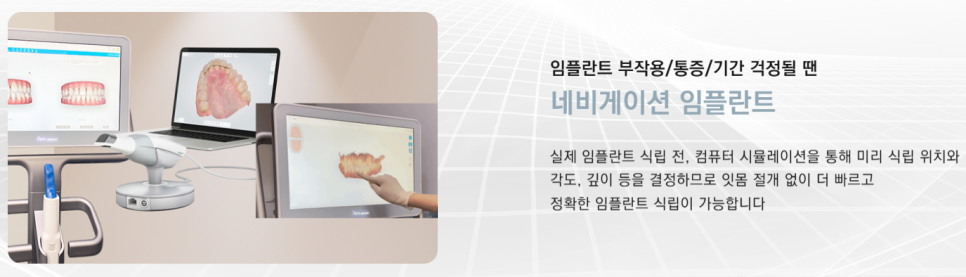 임플란트부작용 걱정된다면 강남새로치과 네비게이션 임플란트 (임플란트통증) 관련 이미지 1
