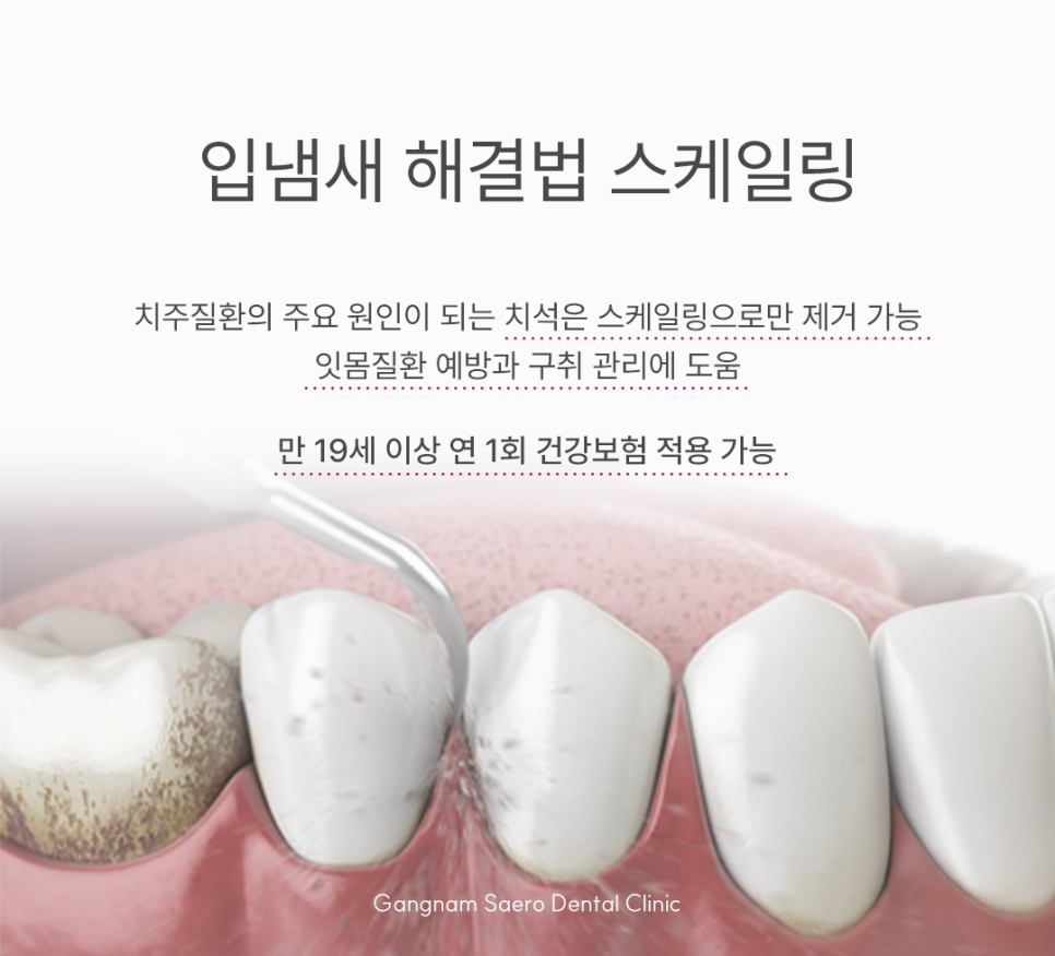 Bad Breath Clinic: What If You Have Bad Breath Even Though You Brush Regularly? image 7