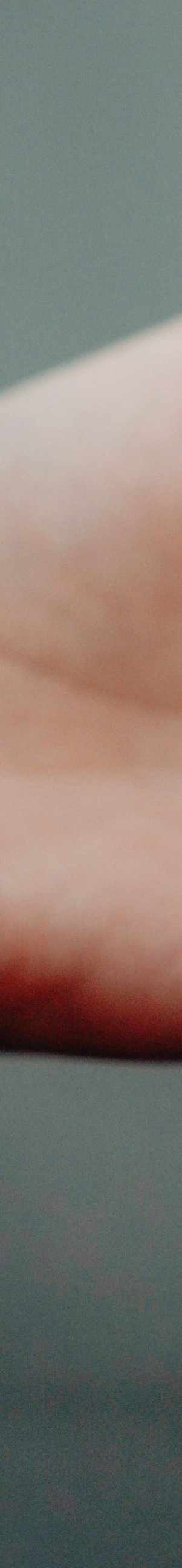 성인치아교정 치료, 부정교합, 구강 건강 개선이 될까요? 고민하고 계시다면 궁금증 타파해드립니다! 관련 이미지 6