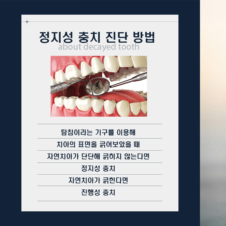 양심치과가 말해주는 모든 충치가 치료해야 하는 건 아니다? (정지성충치) 관련 이미지 5