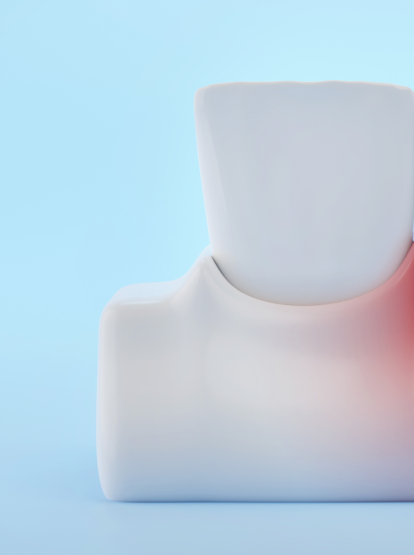 잇몸뼈 녹음이 발생하는 원인과 해결 방법 관련 이미지 4