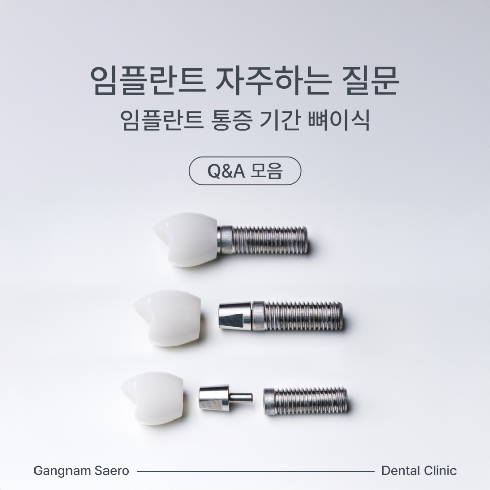 임플란트 자주하는 질문 통증, 기간, 뼈이식 Q&A모음 관련 이미지 1