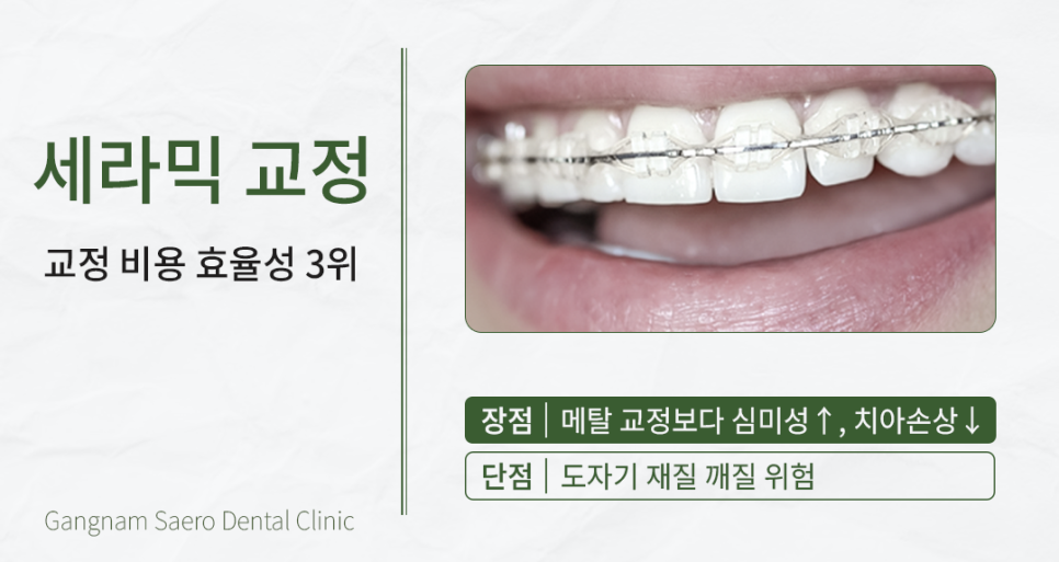 A Time- and Money-Saving Approach to Orthodontic Treatment (Orthodontic Treatment Cost) image 4