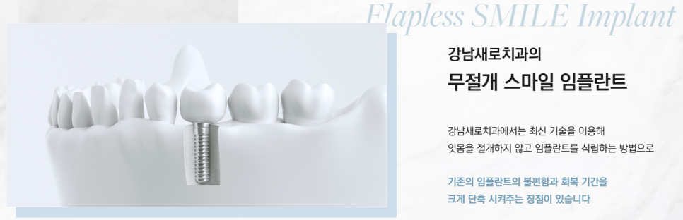 역 도보 5분 근처치과 진료목록 (강남새로치과) 관련 이미지 2