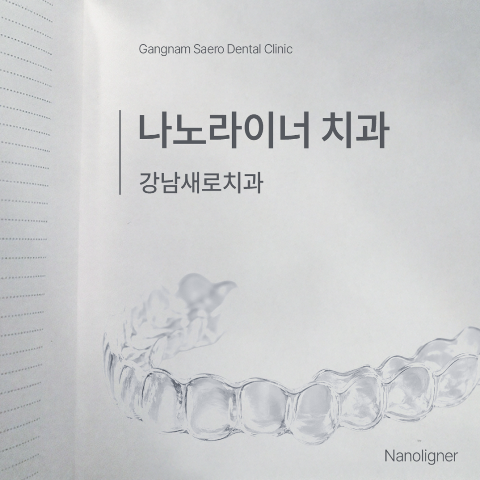 나노라이너란 무엇인가요? (투명교정종류 나노라이너) 관련 이미지 9