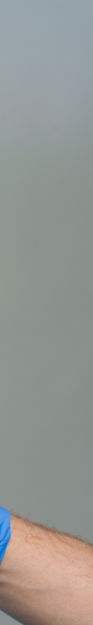 치아교정부작용. 종류와 예방 방법, 교정은 치료 잘 하는 곳에서! 관련 이미지 15