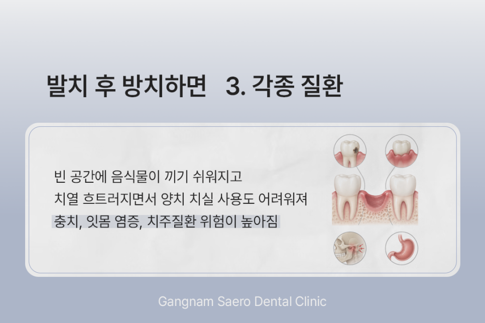 What Happens If You Do Not Get an Implant After Tooth Extraction? (Implants After Tooth Extraction) image 5