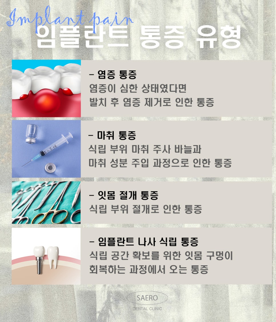 임플란트 많이 아픈가요? 무통증임플란트 (임플란트통증) 관련 이미지 3