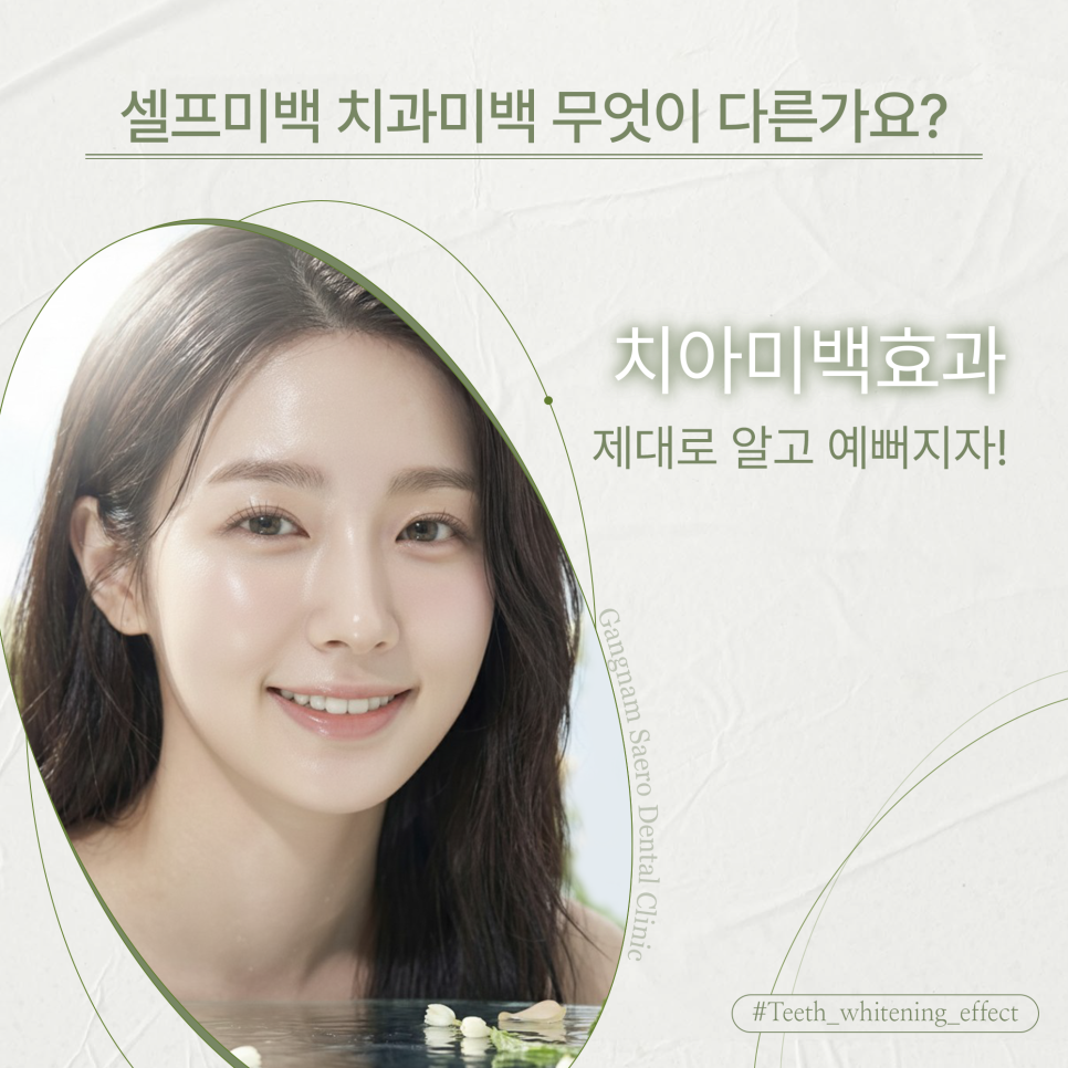 셀프미백 치과미백 무엇이 다른가요? 제대로 알고 예뻐지자! (치아미백효과) 관련 이미지 1