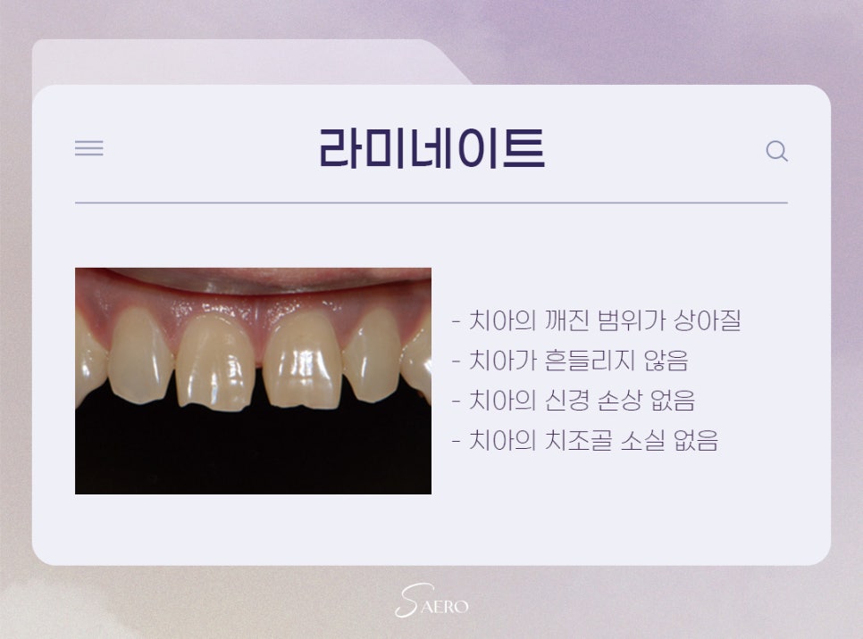 앞니 손상 시 치료 방법 (앞니깨졌을때) 관련 이미지 5