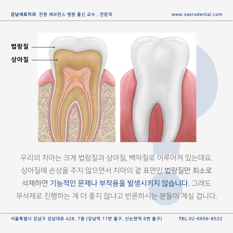 강남라미네이트, 무삭제가 최고? 전문의가 진실을 알려드립니다. 관련 이미지 7